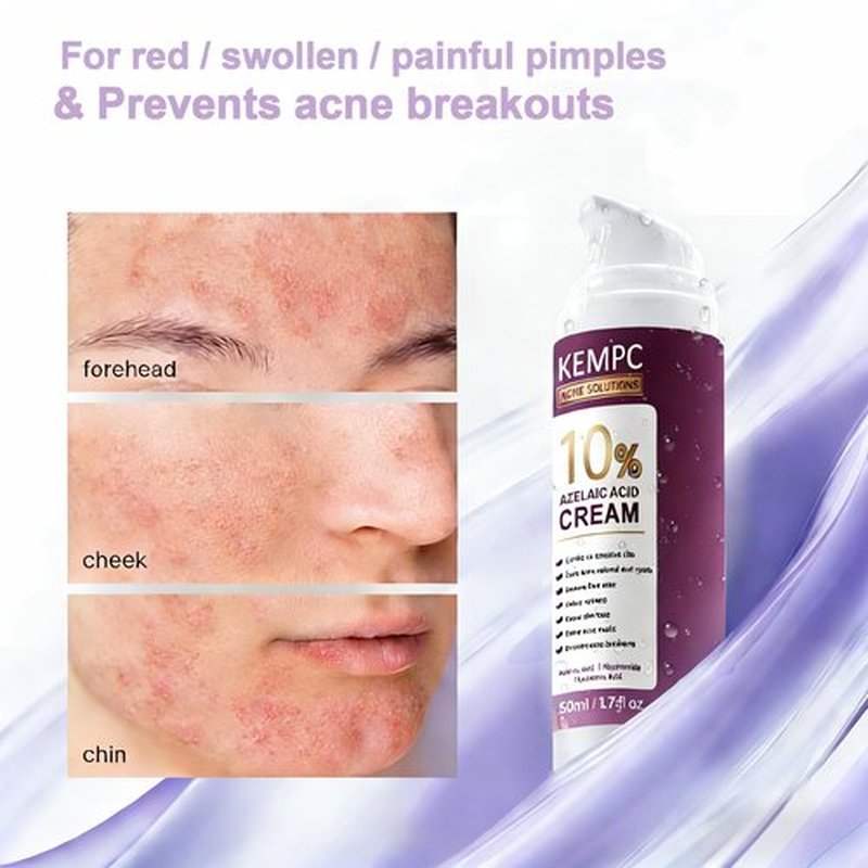 Cystic Acne Treatment for Face – Hormonal Acne Spot Treatment Pimple Cream with Azelaic Acid | Redness Reducing Acne Moisturizer for Rosacea & Sensitive, Acne-Prone Skin | Teens & Adults, 1.7 oz