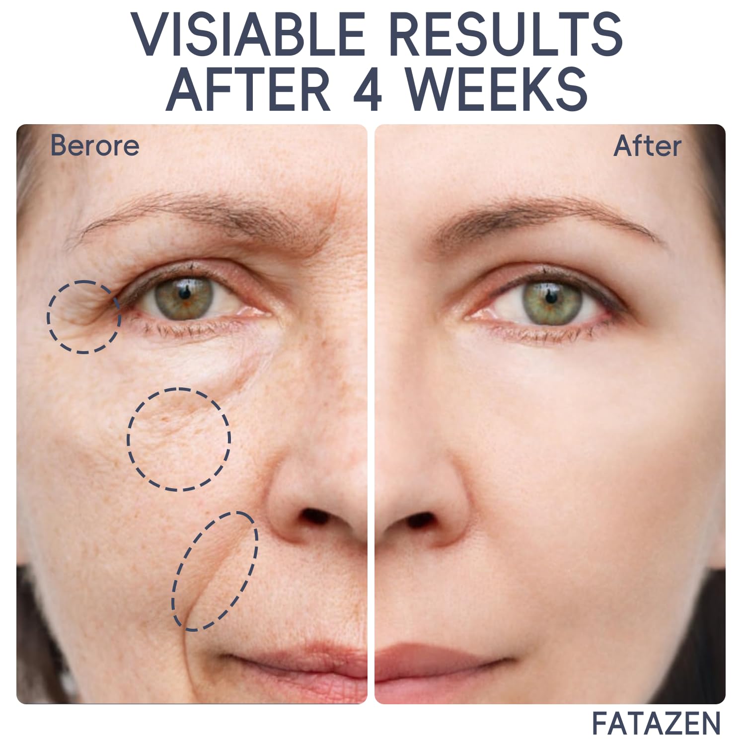 FATAZEN Grass Feed Handmade Whipped Beef Tallow Cream for Skin, Anti-Aging Skincare Face & Body Cream with Retinol & Niacinamide, Non Greasy hyaluronic acid Moisturizer for All Skin Type, 3.53 oz.