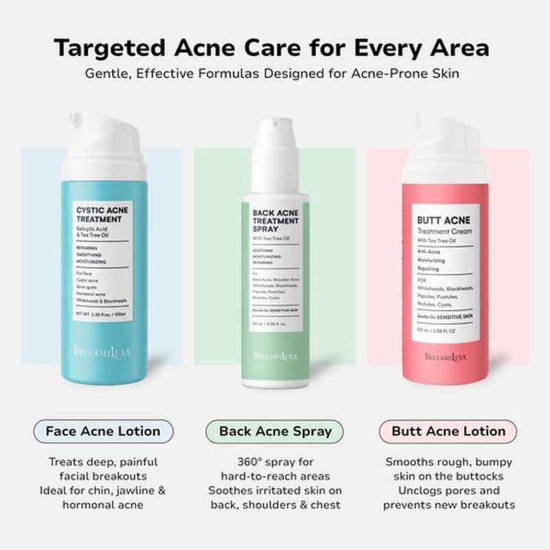 BellamiLuxx Cystic Acne Treatment for Face: Hormonal Acne Treatment Cream for Teens & Adults - Salicylic Acid & Tea Tree Oil Pimple Spot Remover - Anti-Acne Moisturizer Reduces Redness, Blemishes