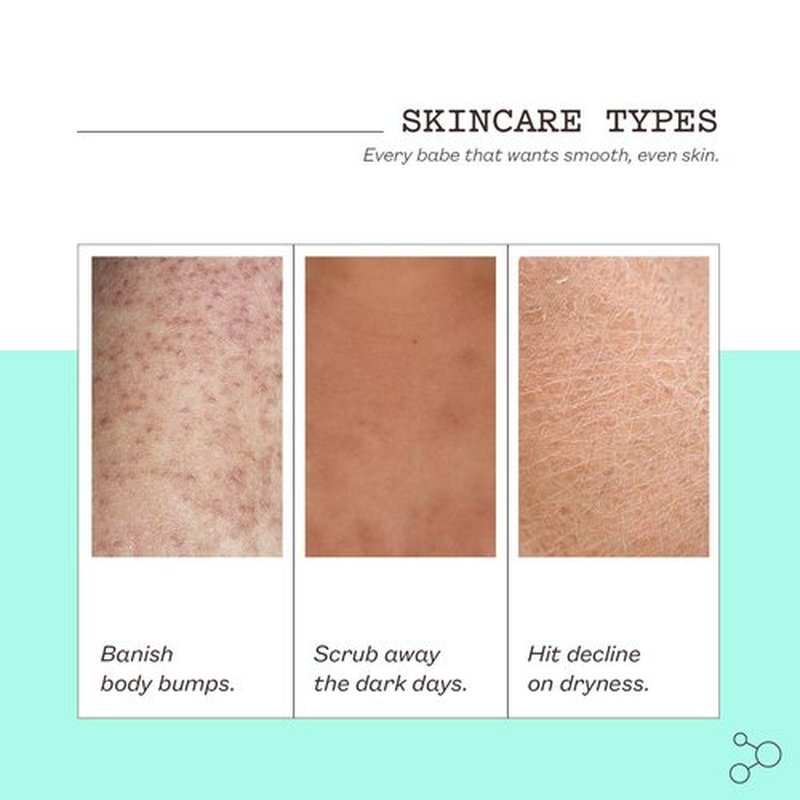 Frank Body Glycolic Acid Body Scrub - Fights KP, Breakouts & Tightens Pores | 8.82 oz