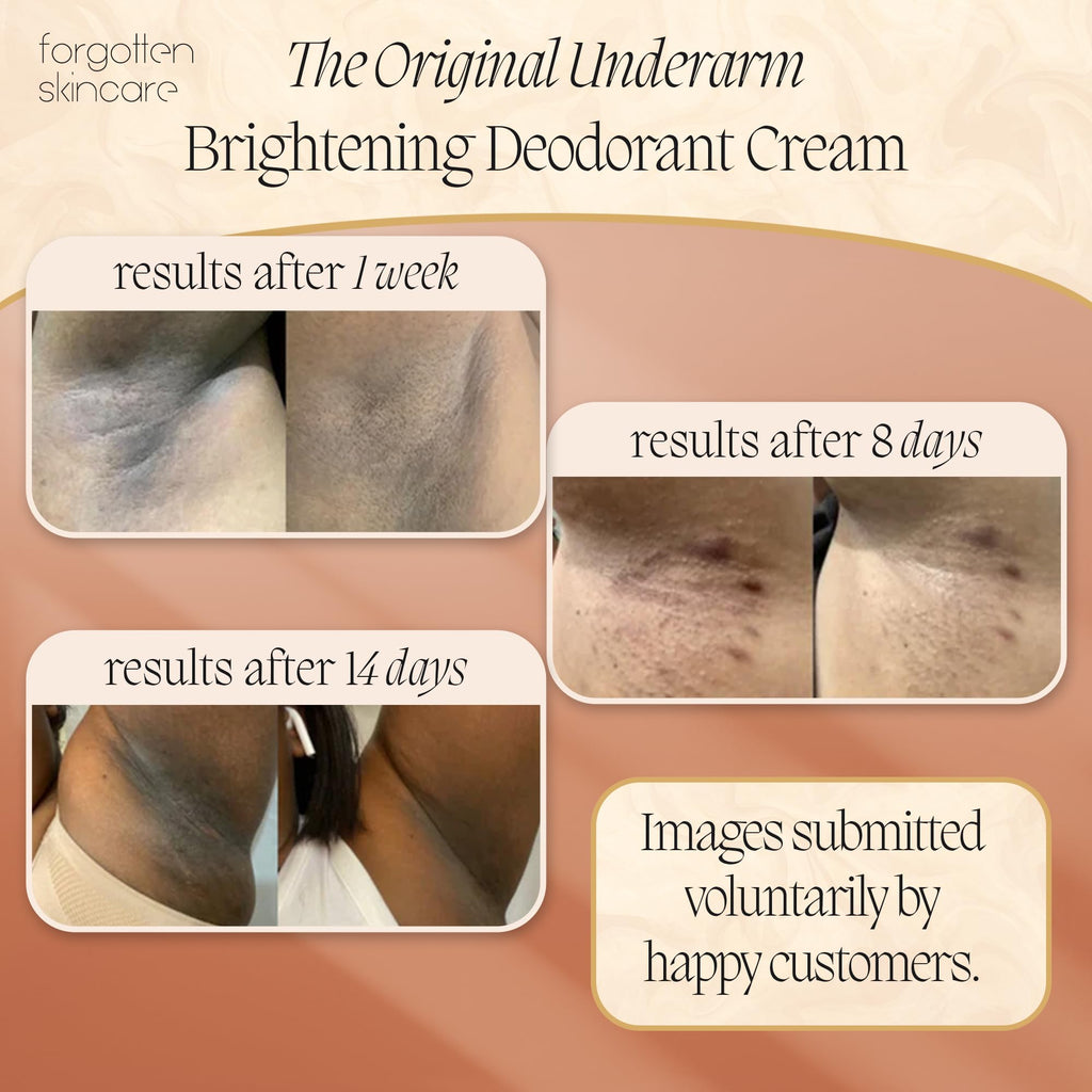 Forgotten Skincare The Original Underarm Brightening Deodorant Cream For Dark Underarms Treatment, Body Odor Eliminator For Women & Men, Ingrown Hair Treatment, Vitamin C & Salicylic Acid