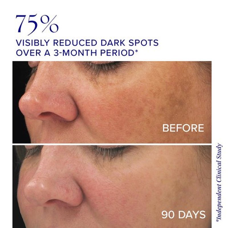 iS CLINICAL Brightening Complex - Skin Brightening Treatment for Age Spots & Uneven Tone