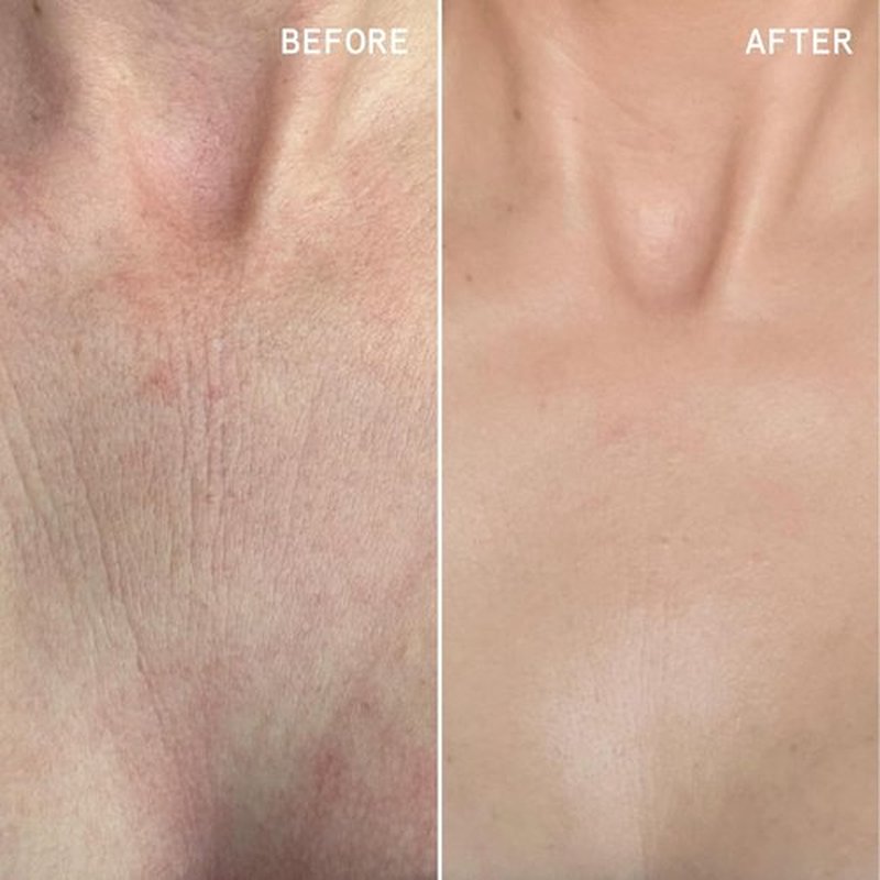 Beauty Pie Über Youth Neck & Chest Tightening Serum Spray - Firming Anti-Aging Formula | 3.2 fl oz