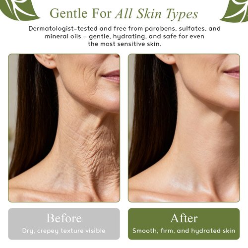 Crepe-Ease Body Moisturizer - Anti-Aging Retinol Cream for Firming & Hydrating Crepey Skin | 4 oz