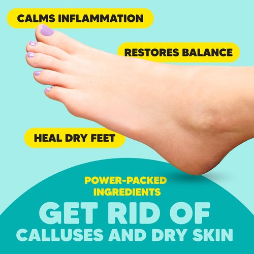 Onyx Professional Foot Peel Mask Callus Remover, 2 pack - Dead Skin Remover, Foot Exfoliator, Cracked Heel Repait, Peeling Callus Removing Foot Mask Pedicure Kit For Smooth Soft Healthy Feet