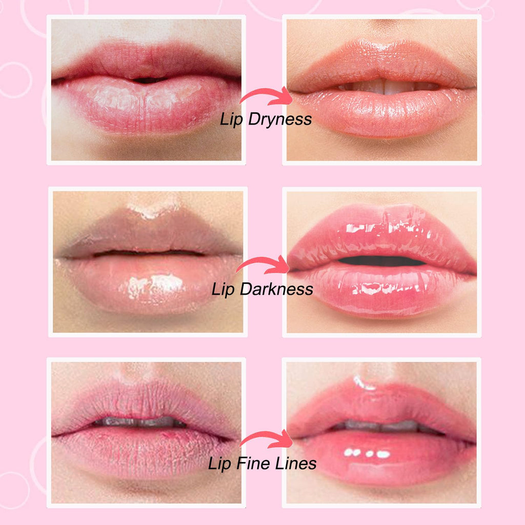 NIYET 30 pieces of Moisturizing Collagen Crystal Lip Mask - Anti-Ageing & Anti Chapped, Reduce lip Wrinkles, Fade Lip Color, Make Skin Smooth (Rose)