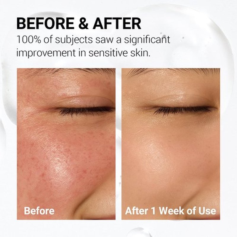 NEAF NEAF Soothing Calm Toner Pad, Daily Gentle Exfoliating & Hydrating Facial Pads for Intense Soothing Care, Heartleaf Extract and CICA for Sensitive Skin Safe, Korean Skincare (60 Pads)
