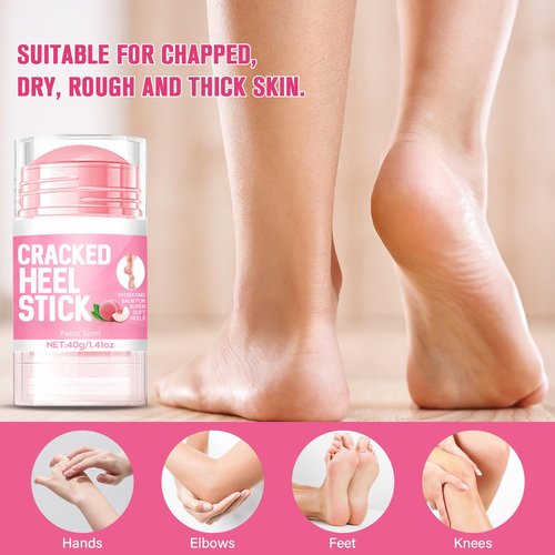 GHENGUA 2PCS 60% Urea Hydrating and Anti-Cracking Foot Cream，2025 Upgraded Hand and Foot Cream Urea Moisturizer，Hydrates Dry and Cracked Feet and Hand (1.41 Ounce, Peach)