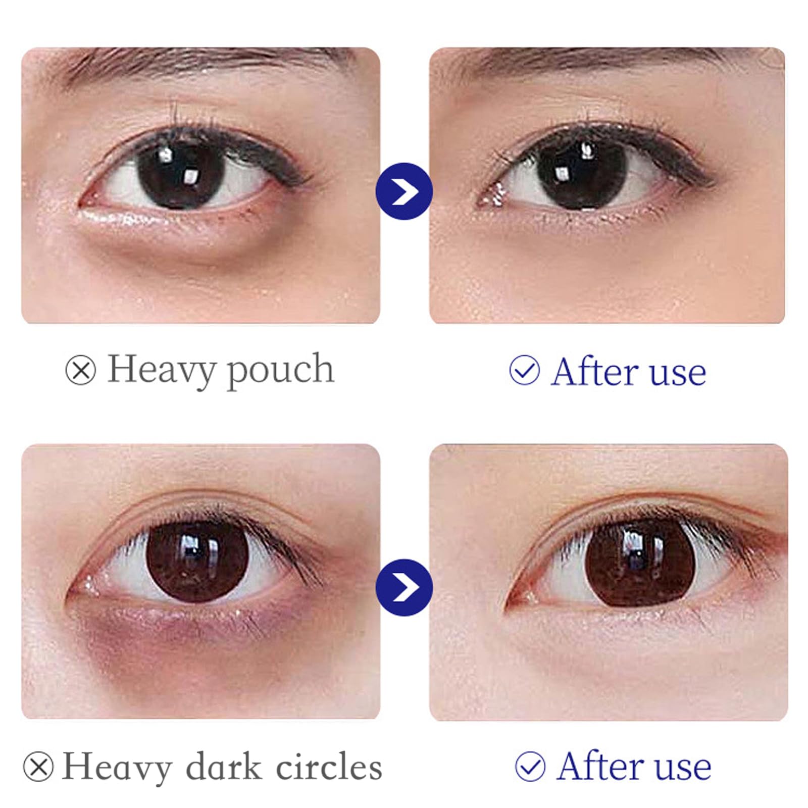 Yniquet 2PCS Age Correcting Eye Cream, Collagen Moisturizing Eye Cream for Anti Aging Eye Serum for Dark Circles Puffiness and Bags for Women Nourishing Repair Tightening and Lifting