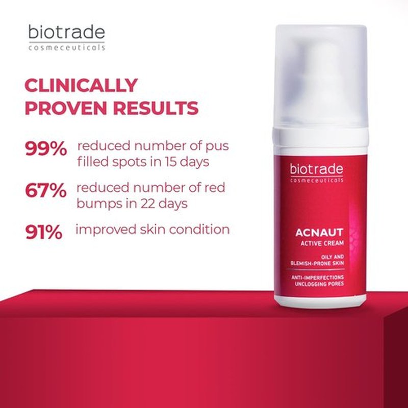 Acne Out Cream 30ml - Powerful Anti-Acne Treatment for Pimples, Blackheads & Whiteheads