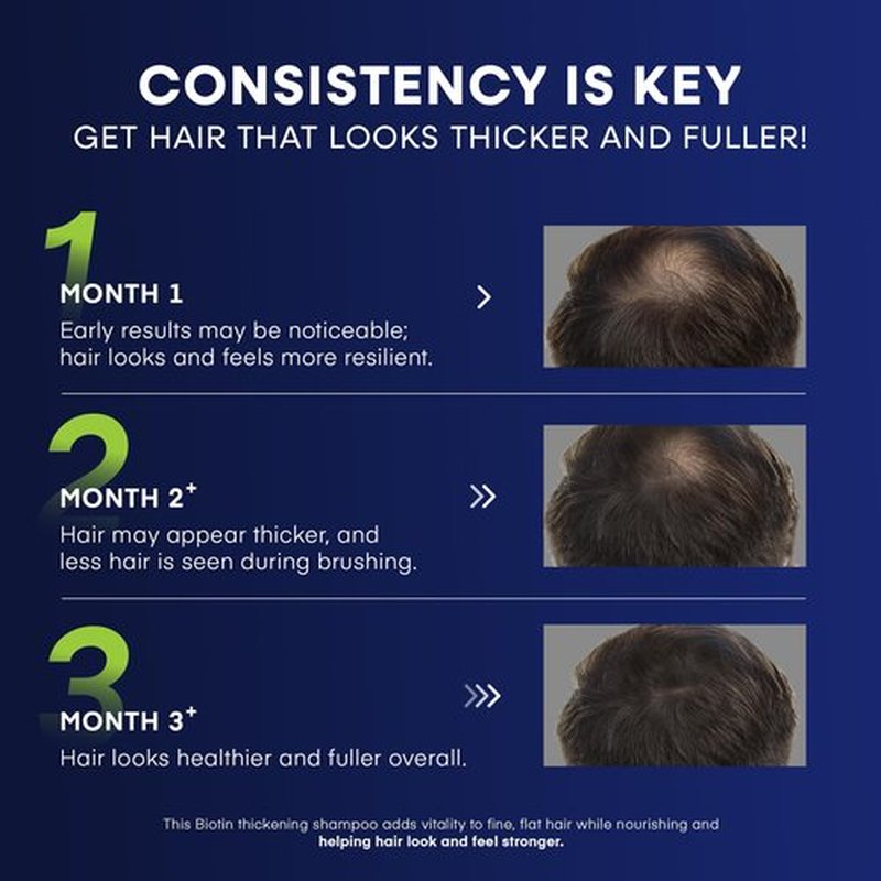 Svvimer Biotin Hair Growth Shampoo - Root Activator Thickening Shampoo for Men - With Rosemary Tea Tree Oil Caffeine For Hair Loss And Thinning Thickening - 13.5 Fl Oz (Pack Of 1)
