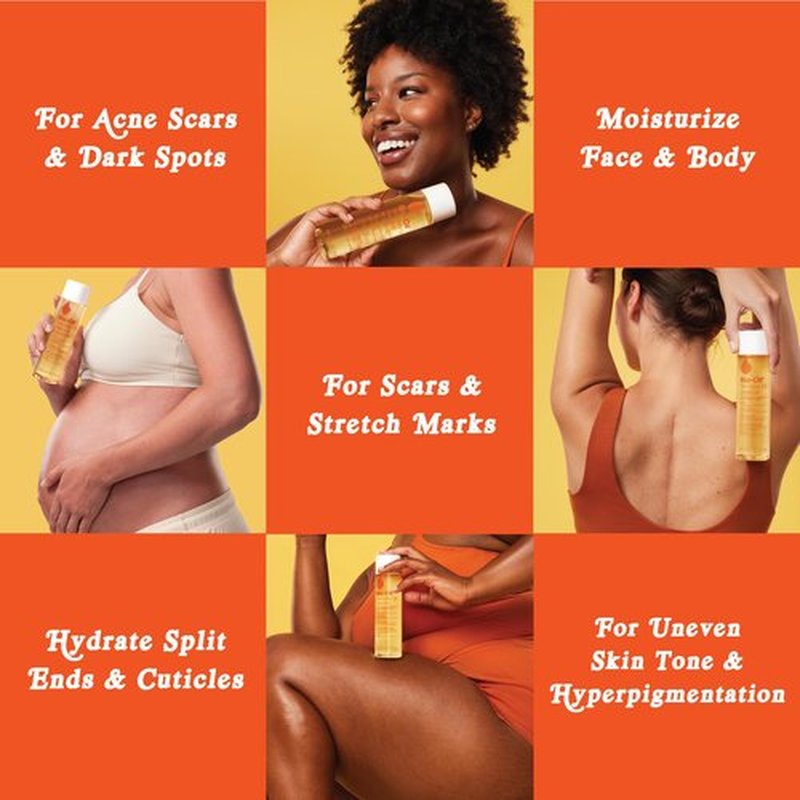 Bio-Oil Natural Skincare Oil Serum, Face and Body Moisturizer with Chamomile, Rosehip, and Lavender Oil, for Scars, Stretch Marks, Sensitive Skin, All Skin Types, 0.85 Oz, Pack of 3