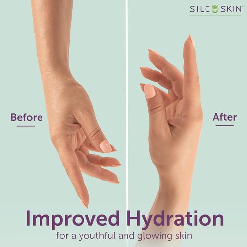 Silcskin Hand And Body Treatment Water Based Lotion For Crepey Skin And Fine Lines With Medical Grade Silicone, Winter Skin Care Gift For Women, 4 Oz