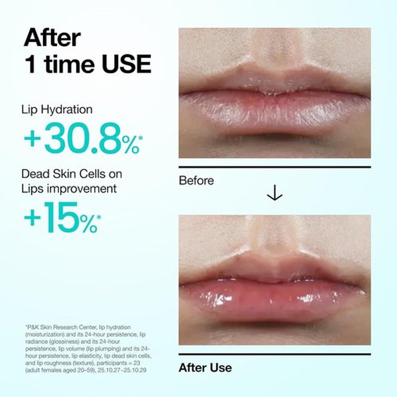 Anua PDRN Lip Serum - Long-Lasting Hydration for Dry Lips | Non-Sticky Moisturizing Care with Salmon DNA & Hyaluronic Acid, 0.33 fl. oz.