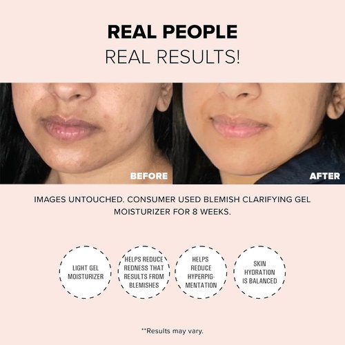 Nudestix Blemish Clarifying Gel Moisturizer - Lightweight Salicylic Acid Acne Treatment with Niacinamide & Cica | Hydrating Vegan Formula for Clear, Balanced Skin