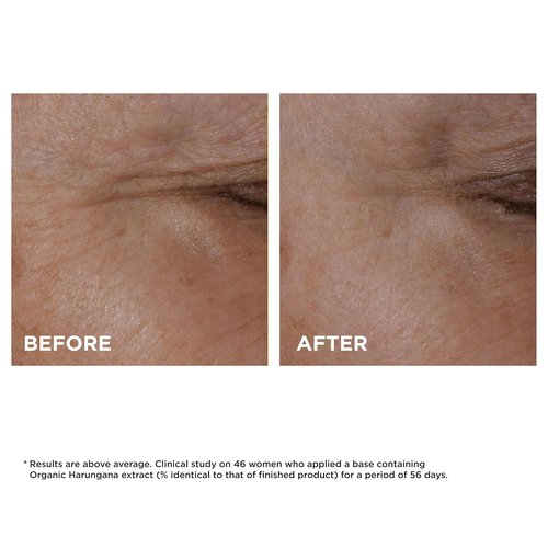 Clarins Total Lift Eye Concentrate - High-Performance Lifting Formula, 0.5 Fl Oz