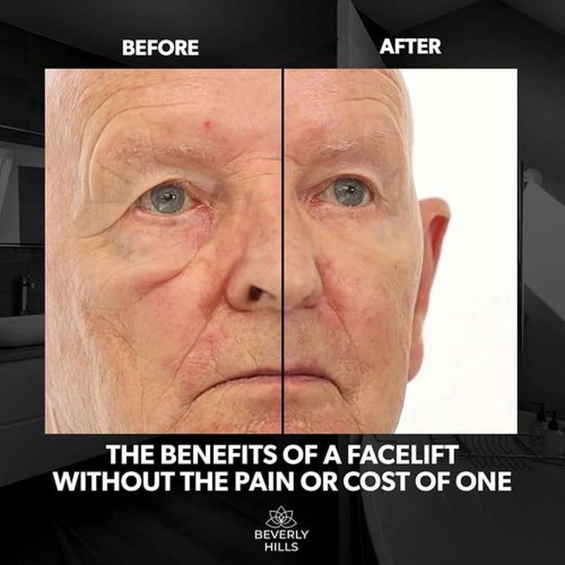 Beverly Hills Instant Facelift Eye Serum - Reduce Dark Circles & Puffiness | Anti-Wrinkle Treatment