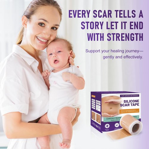 Scar Tape for Surgical Scars – Medical Grade Silicone Scar Sheets and Scar Tape for Keloid Removal, C Section Recovery, Tummy Tuck, Burn or Injury Marks, Soft Reusable Silicone Strips (1.6" x 60")