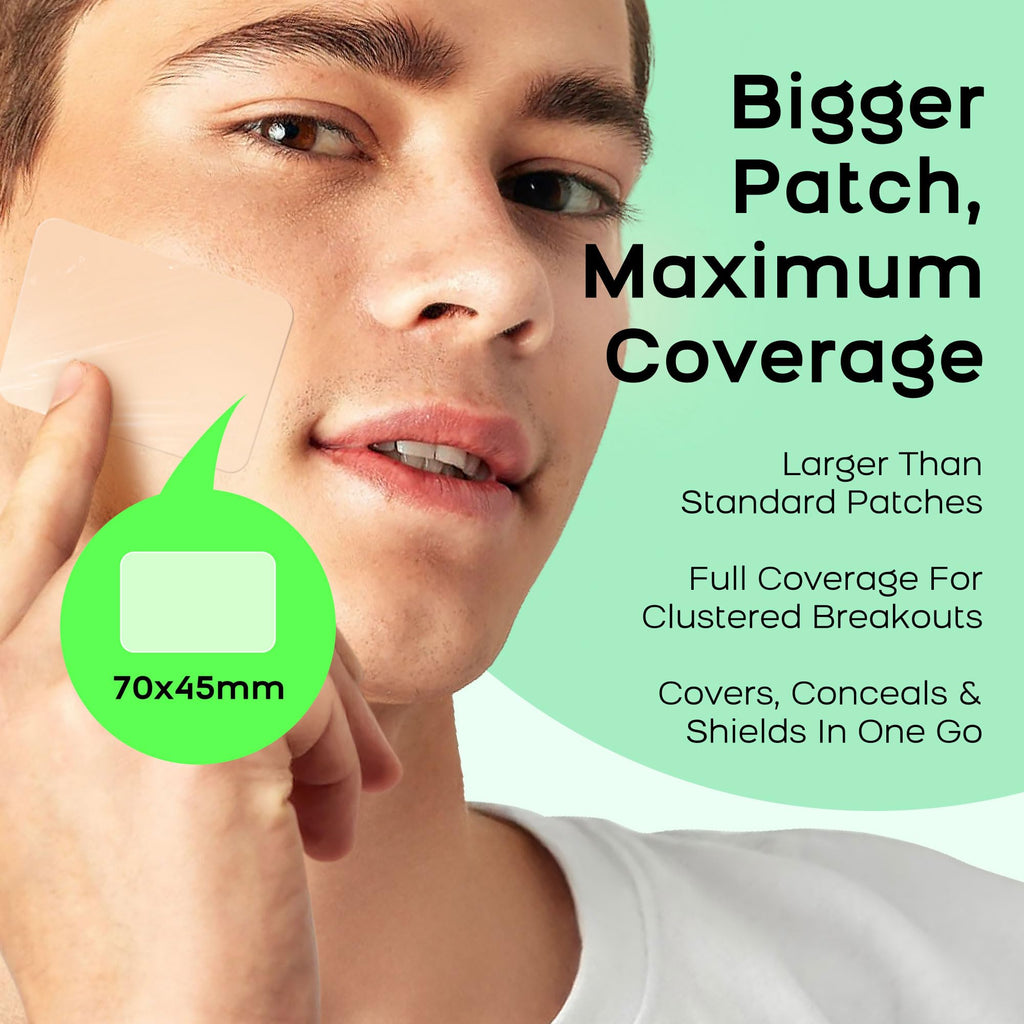 AVAPY XL Hydrocolloid Acne Patches - Extra Large Pimple Patches for Cystic Acne on Face & Body | Nose, Chin, Back & Bacne Treatment | Vegan & Cruelty-Free (8 Count)