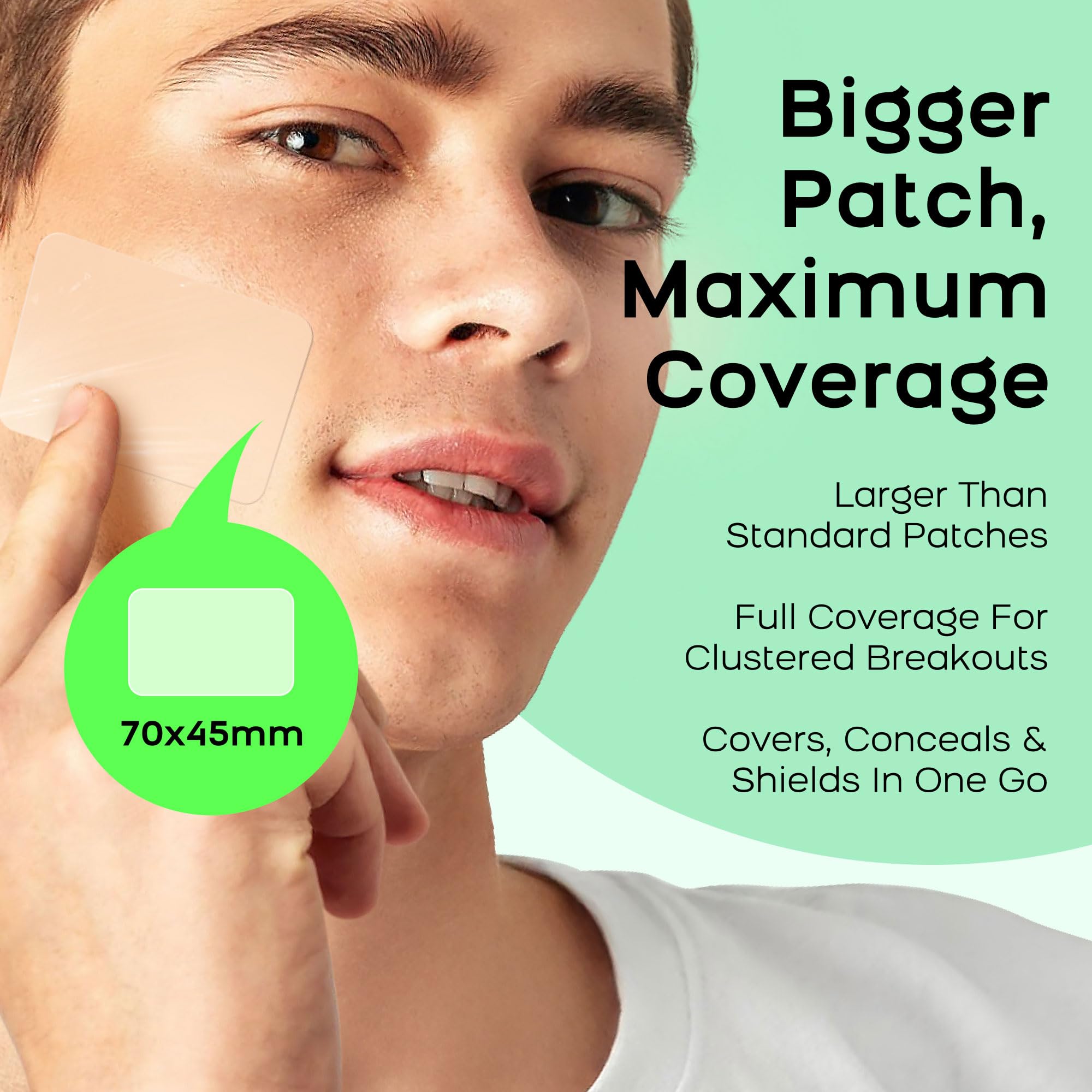 AVAPY XL Hydrocolloid Acne Patches - Extra Large Pimple Patches for Cystic Acne on Face & Body | Nose, Chin, Back & Bacne Treatment | Vegan & Cruelty-Free (8 Count)