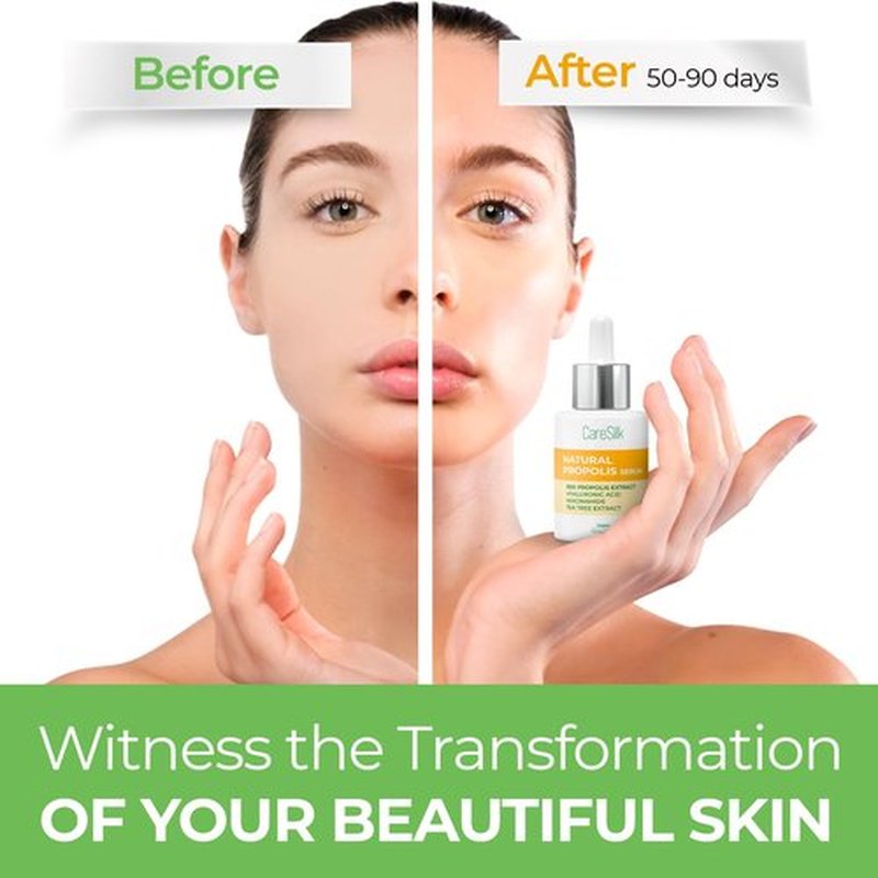 Caresilk Propolis Serum - Face Hydrating Serum - Niacinamide, Hyaluronic Acid, Centella Asiatica, Tea Tree, Rice Extract - Treatment Essence
