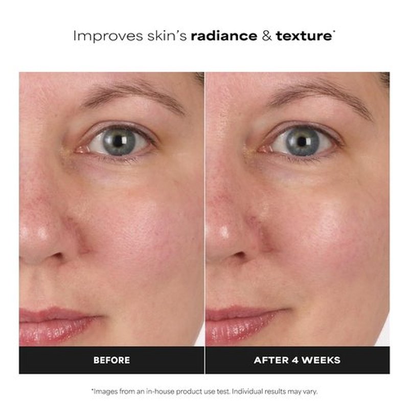 Paula's Choice SKIN BALANCING Face Toner - Pore-Reducing Niacinamide Formula for Oily & Combination Skin | Hydrates & Controls Oil