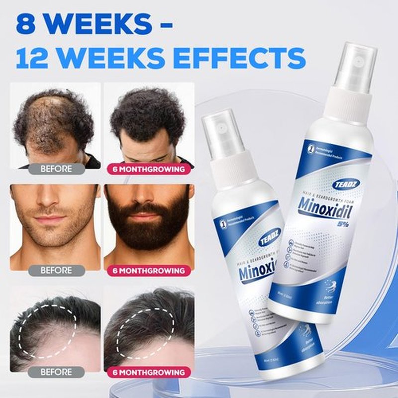 TEADZ 5% Minoxidil for Men and Women，Minoxidil hair growth products，Intense Hair Growth Serum，May Promote Faster, Stronger, Thicker Hair Growth to Fight Hair Loss and Thinning Hair（2.82 oz*2)