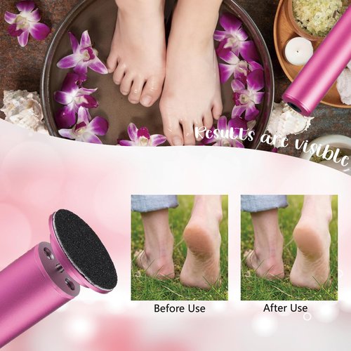 Dermave Upgraded Electric Callus Remover for Feet,Electric Foot File Foot Sander,Adjustable Speed Foot Scrubber,Women Men Dead Skin and Cracked Professional Pedicure Tool,60Pcs Sandpaper Discs