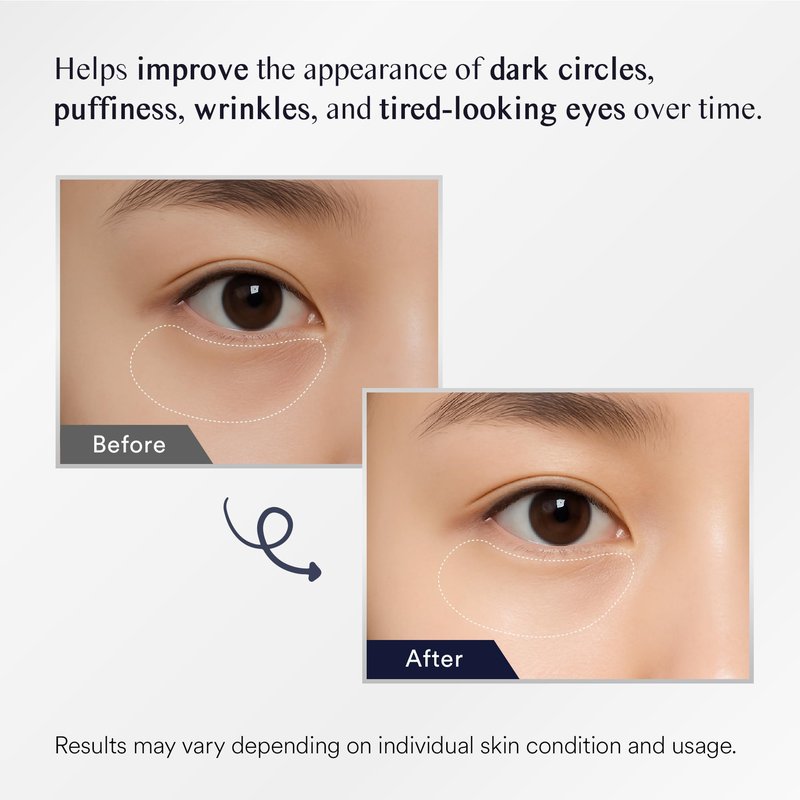 Under Eye Patches for Dark Circles: 30 Pairs Eye Gel Mask for Puffy Eyes and Bags with Retinol Collagen - Undereye Brightening Hydrating Anti-Wrinkles Women