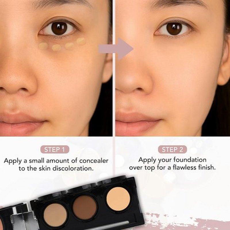 Dermaflage Waterproof Concealer Palette - Full Coverage Matte Finish for Face & Body | Hides Dark Circles & Acne - Medium