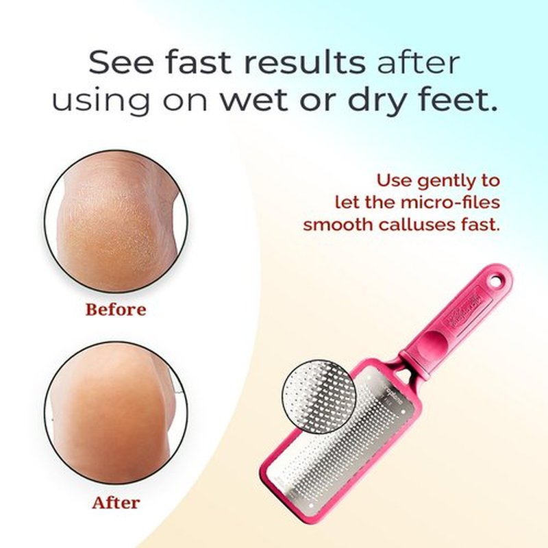 Microplane Colossal Foot File - Original Stainless Steel Callus Remover & Gentle Foot Scrubber | Pink
