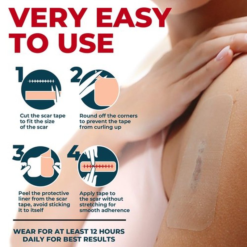 Medical Grade Silicone Scar Tape - 1.6”x150” - Visible Difference on Keloid & С-Section - Reusable Silicone Scar Sheets - Easy to Use
