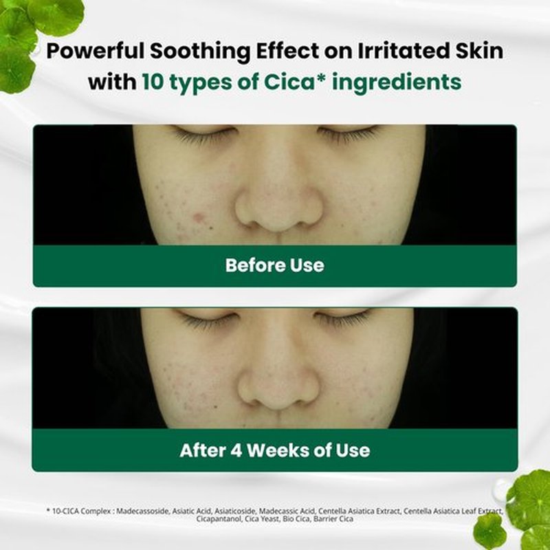 Dr.G Red Blemish Clear Soothing Korean Moisturizer Face Cream, 70ml - Cica Cream, Korean Skin Care Moisturizer, Korean Face Moisturizer, Facial Moisturizer, Korean Skincare, K Beauty Skincare Coreano
