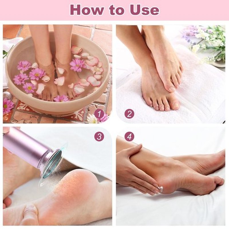 Electric Foot Callus Remover – Foot Callus Remover for Feet with 60 Sandpaper Discs, Adjustable Speed Pedicure Tools for Dead Skin, Professional Electric Feet Callus Remover for Home Use