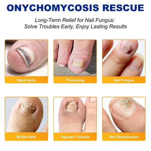 Nail Patches, Rapid Repair Hydrogel Nail Care Stickers, 8 Hours Results | Ultra-Thin and Breathable | Reduces Nail Discoloration | Repairs Damaged Nails, 64 PCS