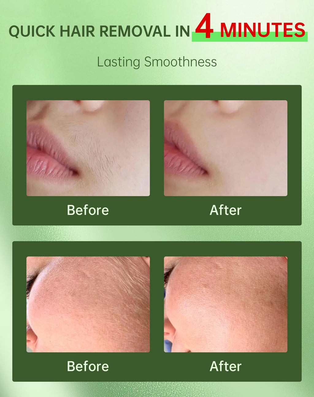 Facial Hair Removal for Women + Soothing Cream 2-in-1 Gentle Painless Hair Remover for Upper Lip, Chin & Sideburns 4-Minute Fast-Acting Depilatory for At-Home Use,2.03 Fl Oz