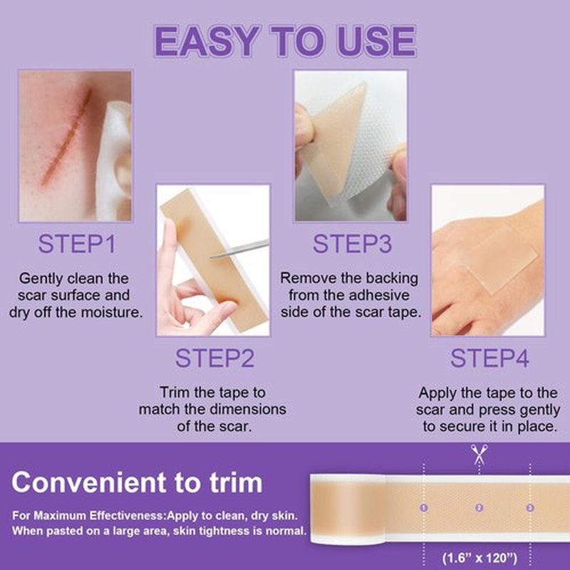 Silicone Scar Sheets, Medical Grade Silicone Scar Tape (1.6" x 60"), Professional Scar Removal Treatment, Reusable, for Healing Keloids, Surgeries Scars, C-sections, and Burns