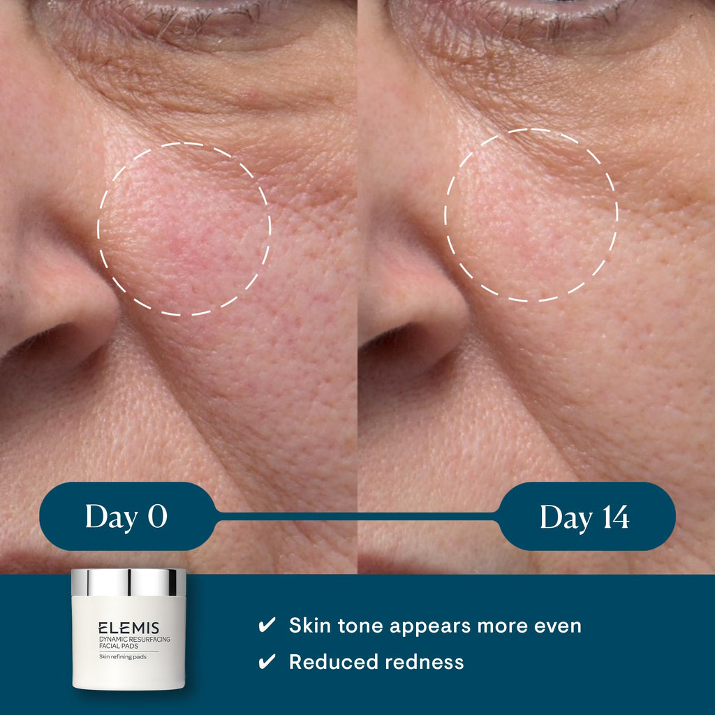 ELEMIS Dynamic Resurfacing Pads and Pro-Collagen Cleansing Balm