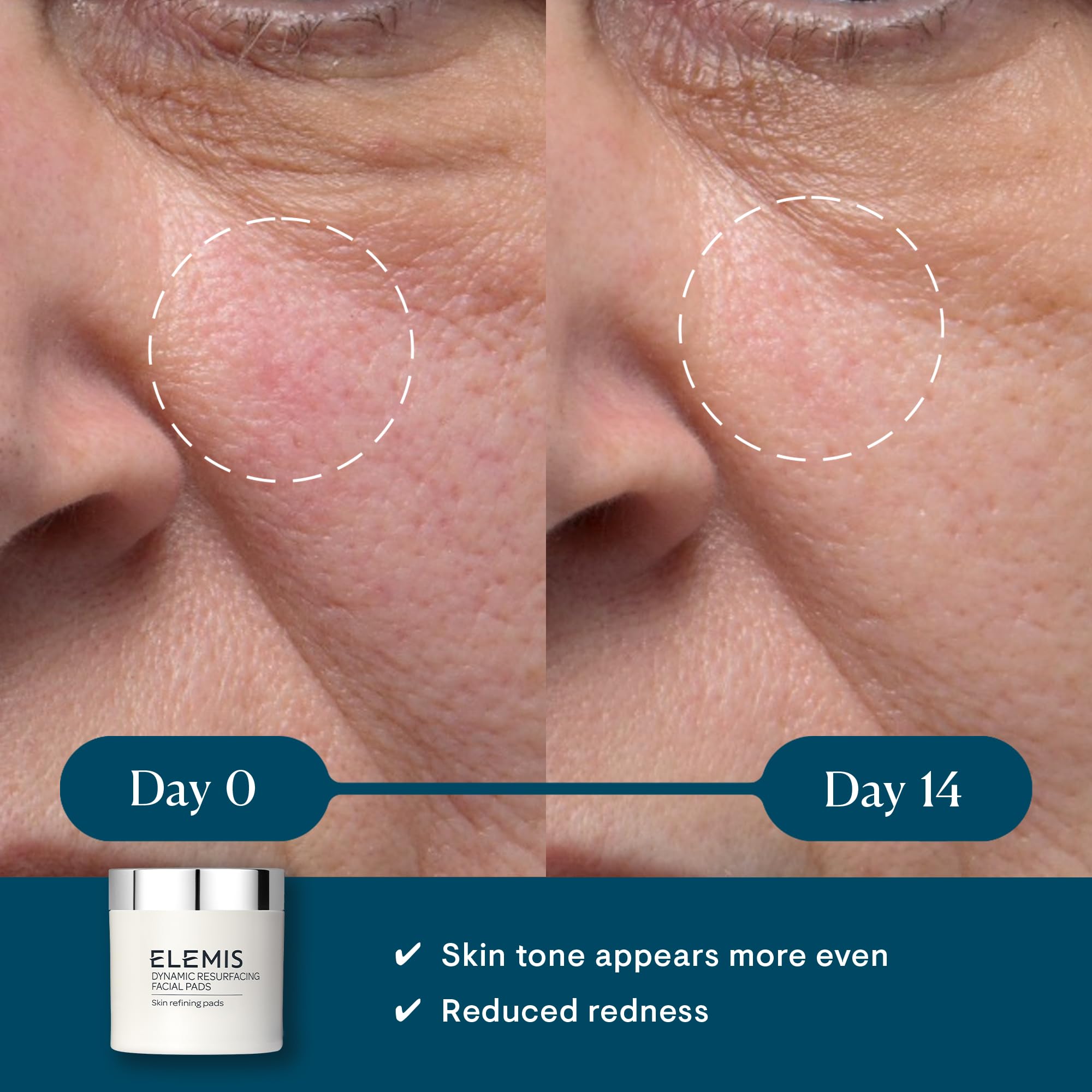 ELEMIS Dynamic Resurfacing Pads and Pro-Collagen Cleansing Balm