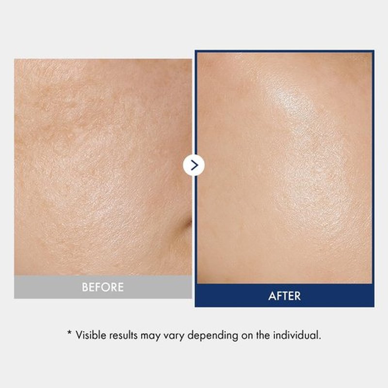 TOSOWOONG Ceramide Barrier Serum, Hydrating Serum for Face, 1,250ppm Ceramide Complex, Niacinamide, Collagen, Panthenol, Centella, Glass Skin, Fragrance-free, Korean Skin Care, 33 ml / 1.11 fl. oz.
