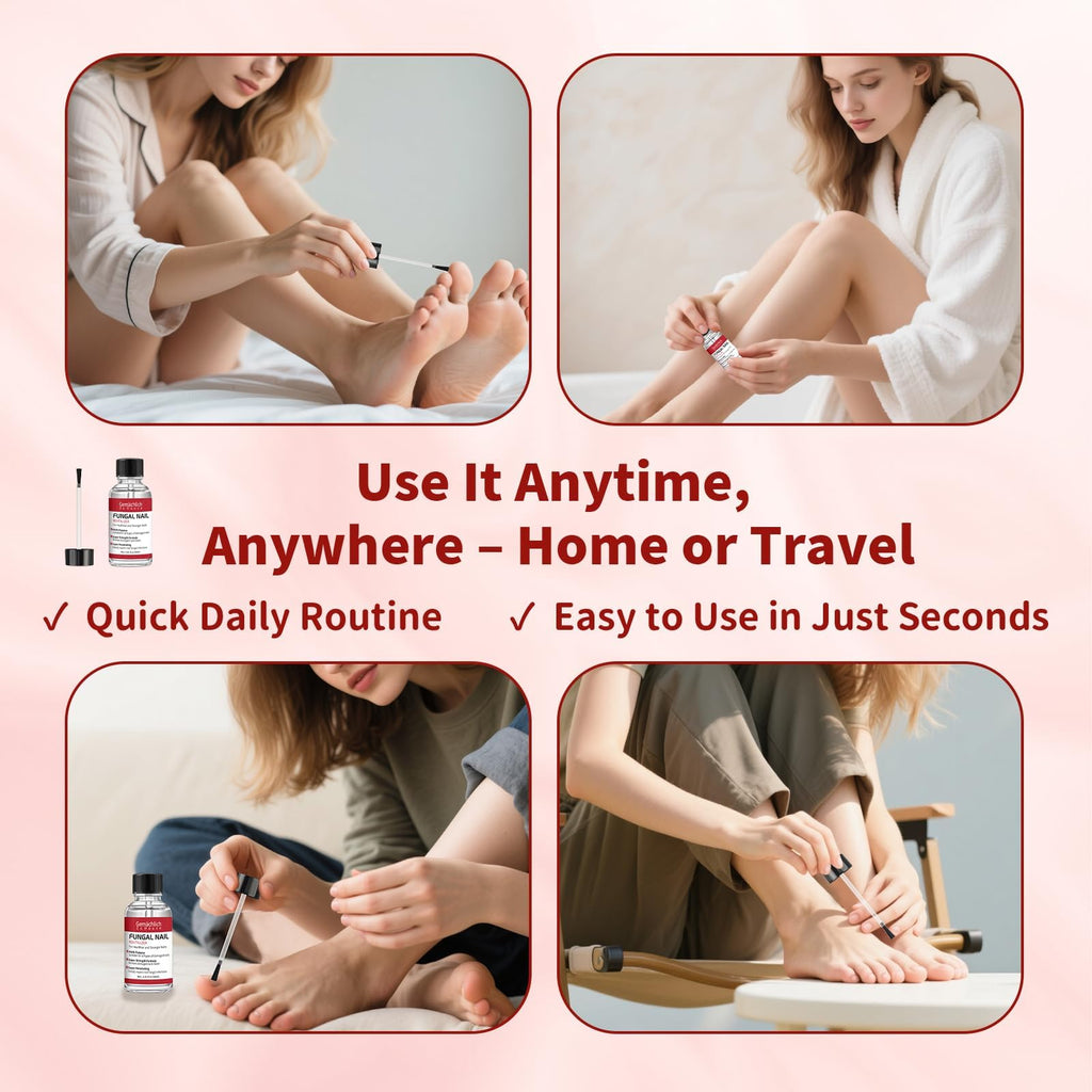 Toenail Fungus Treatment Extra Strength, Nail Fungus Treatment with Undecylenic Acid for Toenail & Fingernails, Antifungal Nail Repair for Athletes Foot, Ingrown, Thick, Broken, Damaged Nail, 30ml
