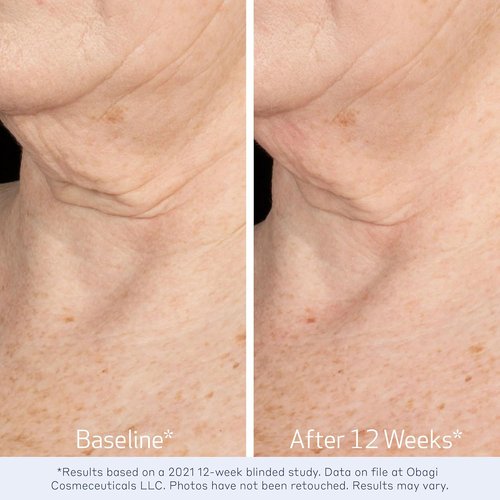 Obagi ELASTIderm Neck & Décolleté Lifting Concentrate - Reduces Fine Lines & Wrinkles | 2 oz