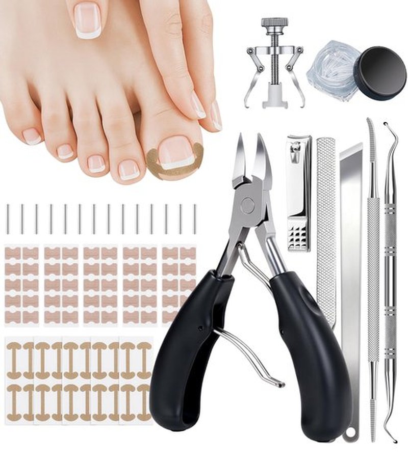 Ingrown Toenail Corrector Set with 50 Positive Nail Strips & 20 Breathable Patches, Professional Pedicure Tool Kit for Curved Toenails, Easy to Use for Beginners