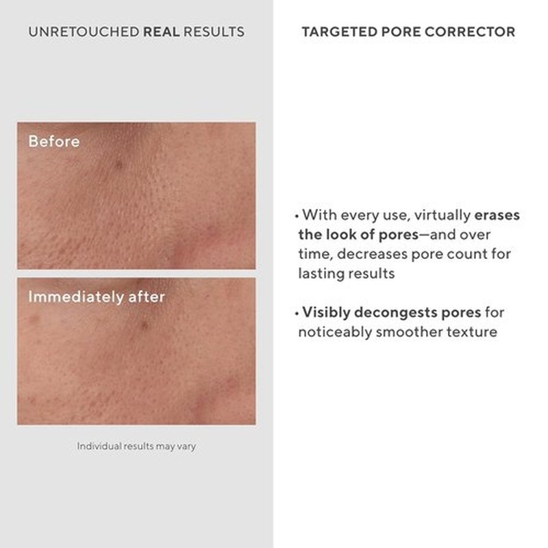 Murad Targeted Pore Corrector - Bio-Tech Copper & Amino Acid Treatment for Instant Pore Minimization | 0.5 Fl Oz