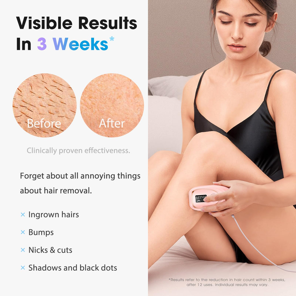 Oreeth Laser Hair Removal Device for Women & Men, At-Home IPL Hair Removal Laser with 45°F Ice-Cooling for Painless & Long-Lasting Results, Permanent Hair Removal for Full Body, Light Pink