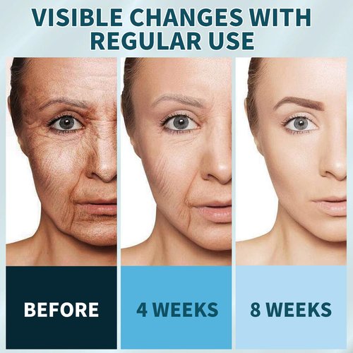 Collagen Retinol Cream for Face Unscented with Hyaluronic Acid Day & Night Moisturizer Face Cream Skin Tightening Cream for Face & Neck Cream Lifting & Recovery Rapid Wrinkles Repair 1.7 Oz