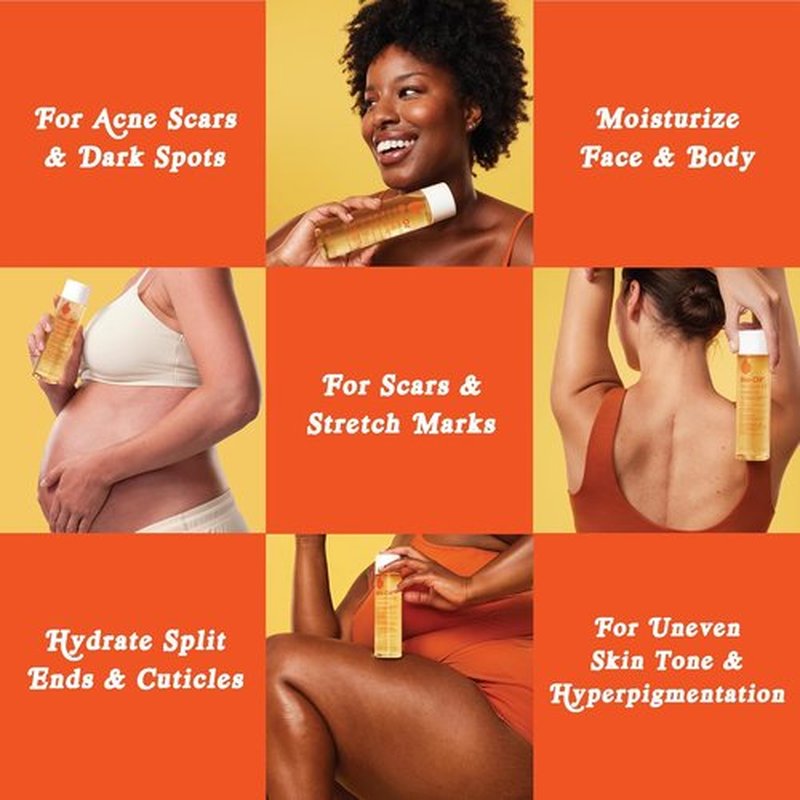 Bio-Oil Natural Skincare Oil - Serum for Scars & Stretch Marks | 6.7 Oz Moisturizer for All Skin Types