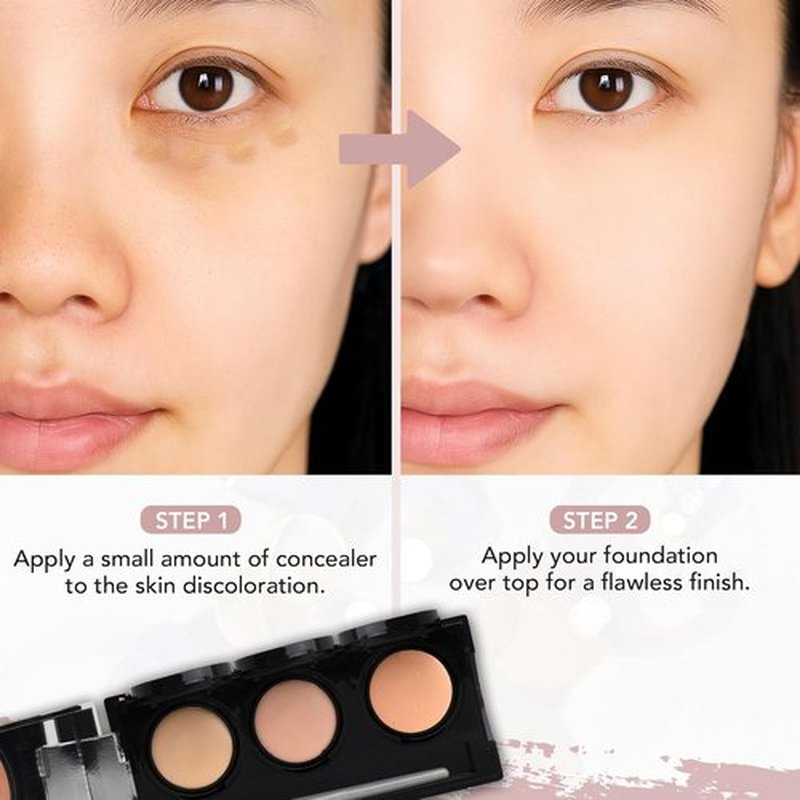 Dermaflage Waterproof Concealer Palette - Full Coverage Matte Finish for Face & Body | Hides Dark Circles & Acne