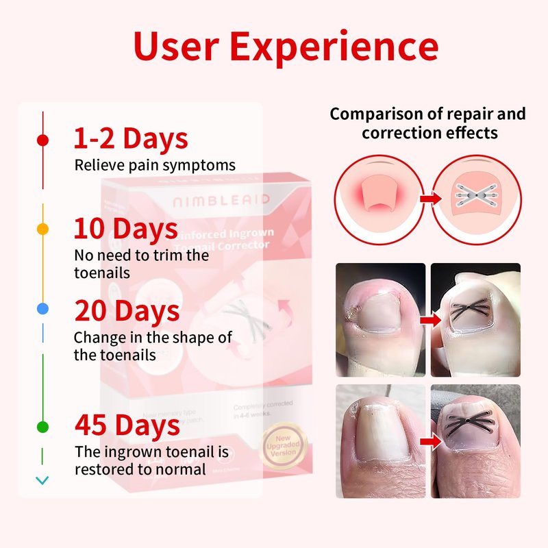 Upgraded Titanium Alloy Ingrown Toenail Corrector with Upgraded 6-Angle Shape,3x Stronger Pull Force,Ingrown Toenail Removal Kit, Ingrown Toenail Treatment for Women and Man (Small Size-6 packs)