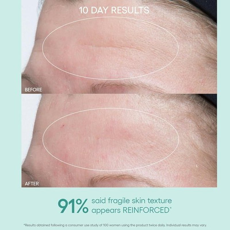 Algenist GENIUS Ultimate Anti-Aging Face Cream - Restores Vegan Collagen for Radiant Skin - 1oz